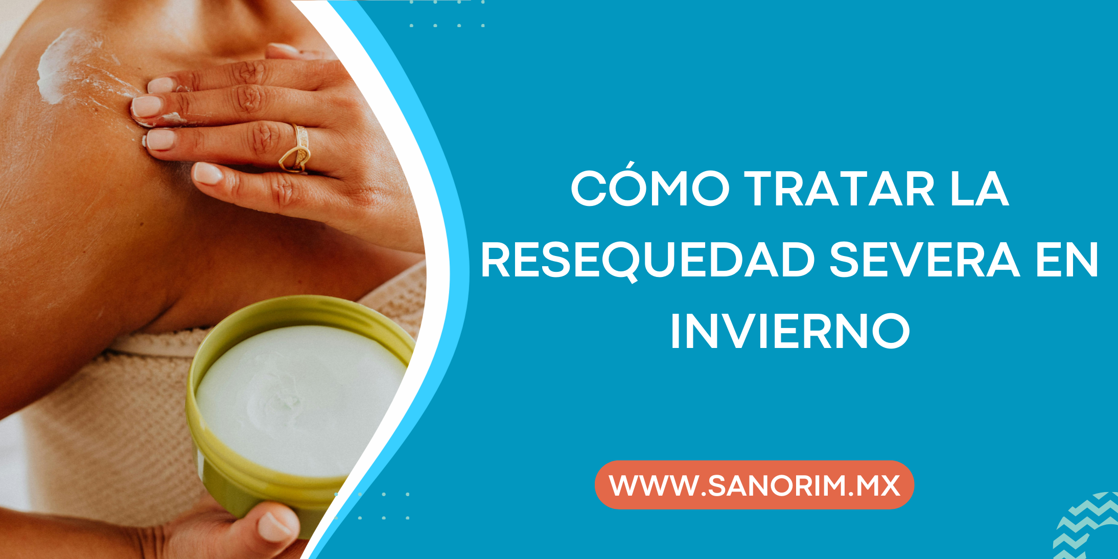 Cómo tratar la resequedad severa en invierno